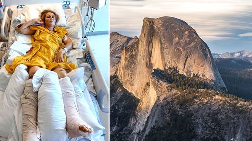 NZ climber Anna Parsons lies in a hospital bed in California, after falling from a rock face in Yosemite National Park.