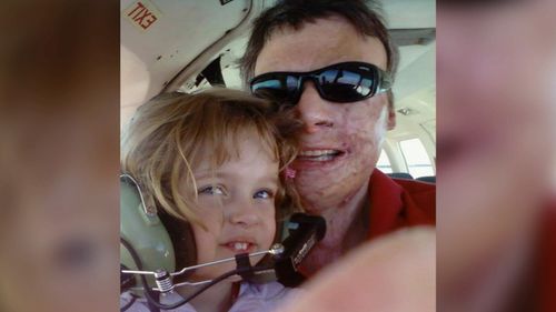 The pilot's daughter Hannah was born six months after the 2005 crash which left him badly scarred. (9NEWS)