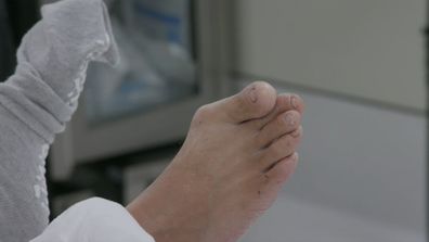 My Feet Are Killing Me 9Now Chris wakes from surgery getting bunion removed
