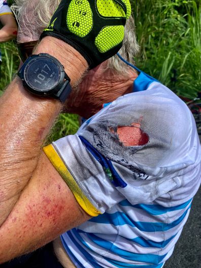 Richard Branson horror bike crash injuries