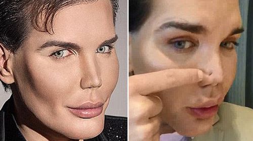 Plastic surgery addict who became Ken doll admitted to hospital with rotting nose
