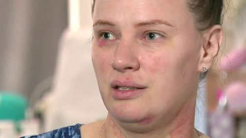 Residen Michelle Filippi suffers from skin irritation and breathing problems, which she says is a result of the air quality.