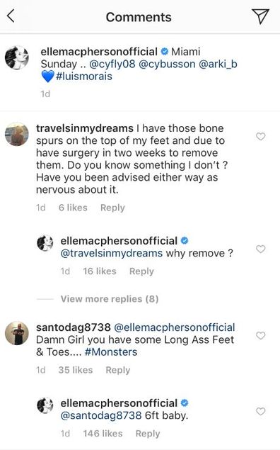 Elle Macpherson's Feet Trolled For Being 'Ugly' & 'Creepy' By