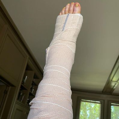 Martha Stewart shared a photo of her foot wrapped in bandages.