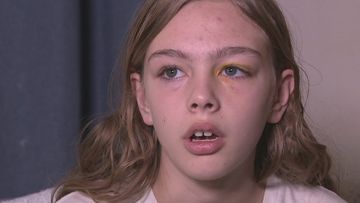 Jasmine Holub, 10, was left traumatised and covered in bruises after she was allegedly attacked outside the Ellenbrook McDonald&#x27;s with her cousin yesterday.