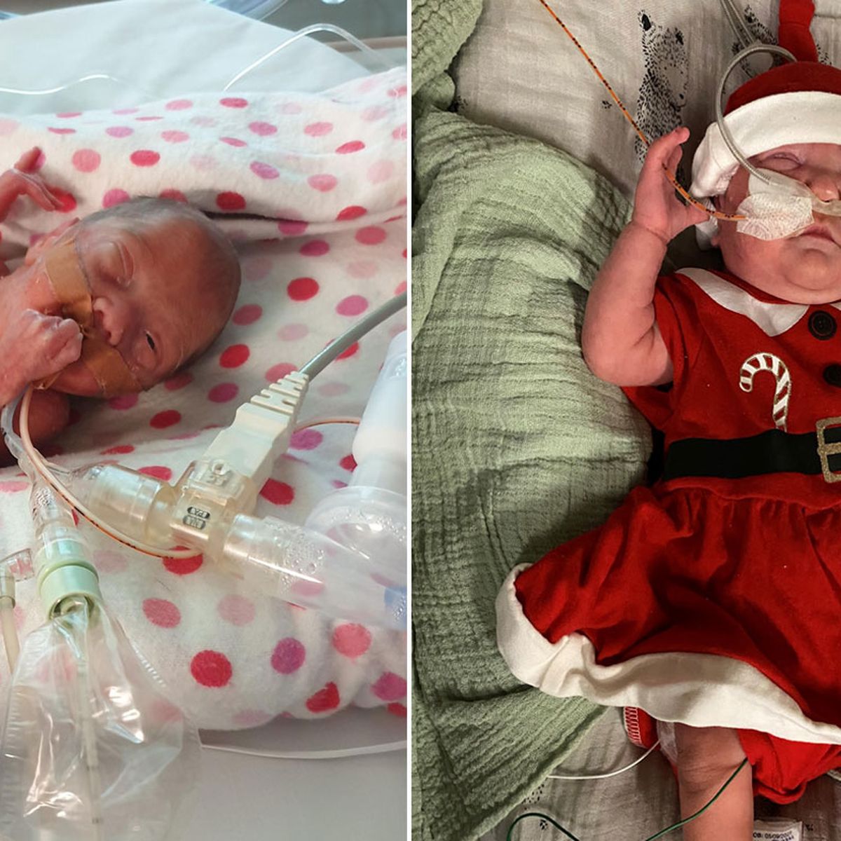 Birth Stories Brisbane Baby Born 17 Weeks Early A Christmas Miracle We Will Fight With Her 9honey