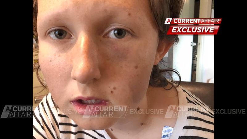 Kayla Kendrigan speaks on alleged ordeal | Nine.com.au
