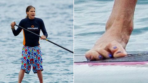 What's up with Steven Tyler's freaky foot?