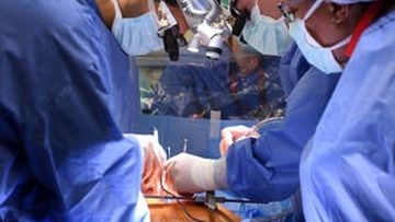 The surgical team from the University of Maryland School of Medicine work as they successfully perform the pig heart transplant.