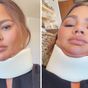 Star shares selfie in a neck brace as she misses the Met Gala