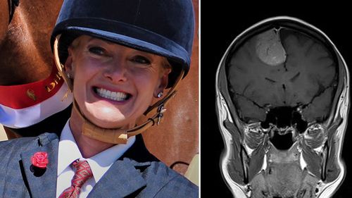 Amanda Doolan suffered skull fractures when she was bucked off head first off a pony when she was in her teenage years.