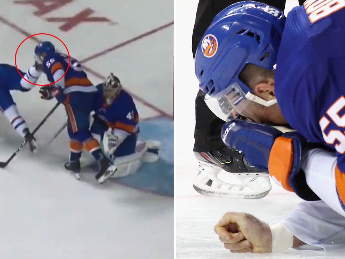 Islanders' Johnny Boychuk takes a skate blade to the face - Newsday