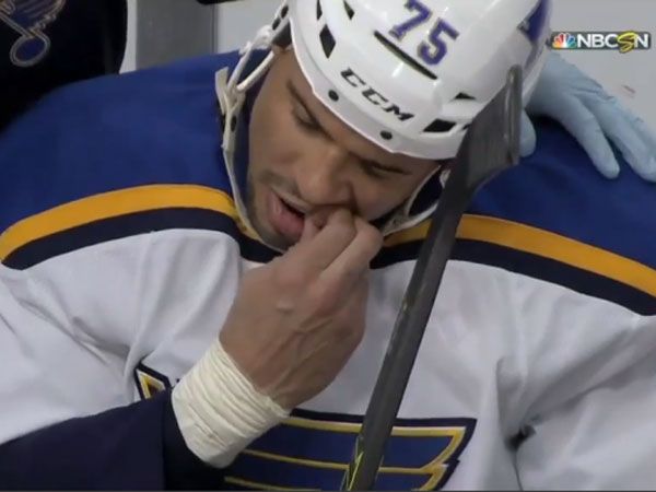 NHL player pulls out own tooth