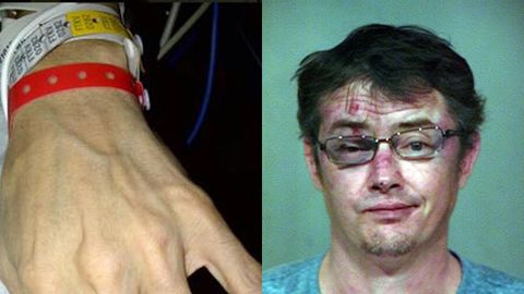 'A brutal attack': '90s star Jason London shows shocking bruises, claims he’s innocent