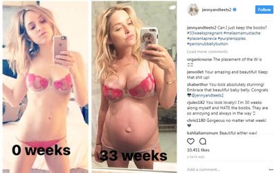 Jenny Mollen Embraces Her Changing Baby Body With Before and After