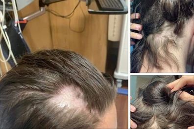 Woman claims shampoo was 'tampered with' after hair falls out