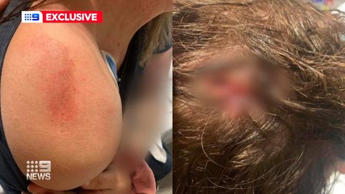 A young mother says she has been left traumatised after being flung from her moving car during a violent carjacking in Queensland.Kayla Barry jumped into the driver's side window of her car to try and stop the thief during at a service station in Dinmore, Ipswich, west of Brisbane.