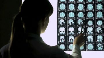 New scanning tool could help paramedics identify a stroke in seconds
