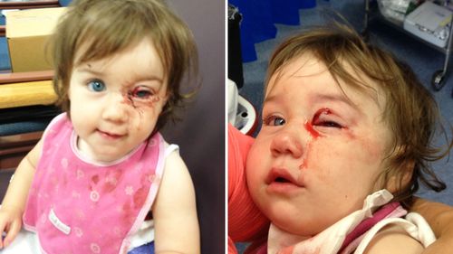 Justine Redwin's daughter Sylvie almost lost her eye after she became impaled on an accessory stand at a Terry White chemist.