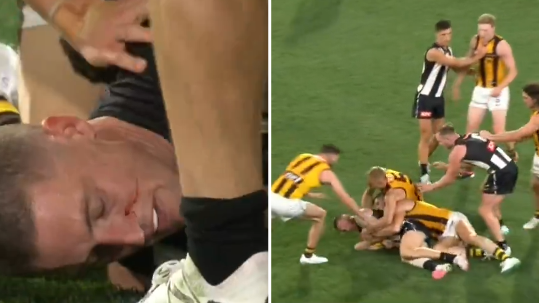 Collingwood issued please explain after Jordan De Goey caught wiping blood from teammate's face