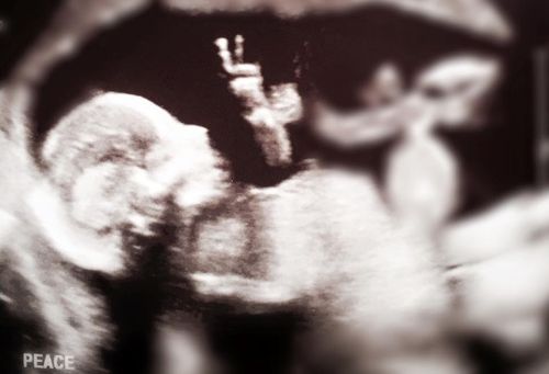 Ultrasound appears to show unborn baby giving parents the peace sign