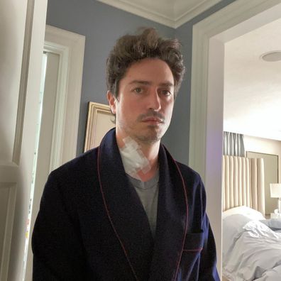 Superstore star Ben Feldman talks spinal surgery.