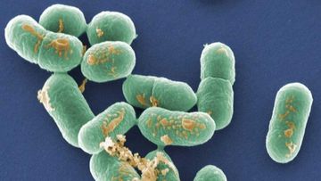 Listeria is a nasty bacteria which is particularly hard to kill.
