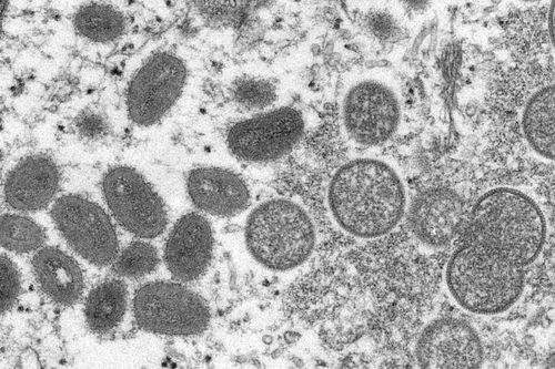 This electron microscopic (EM) image depicted a monkeypox virion, obtained from a clinical sample associated with the 2003 prairie dog outbreak. It was a thin section image from of a human skin sample. On the left were mature, oval-shaped virus particles, and on the right were the crescents, and spherical particles of immature virions. High Resolution:	Click here for hi-resolution image (5.21 MB) Content Providers(s):	CDC/ Cynthia S. Goldsmith Creation Date:	2003 Photo Credit:	Cynthia S. Goldsmi