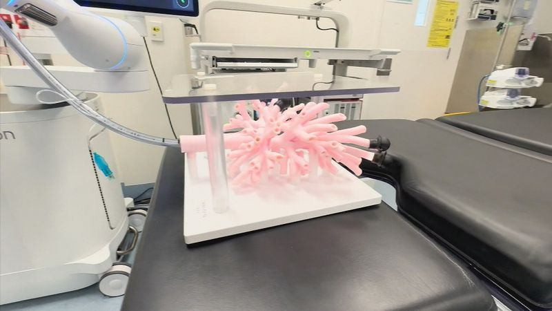 Groundbreaking machine could hold key to early lung cancer detection ...