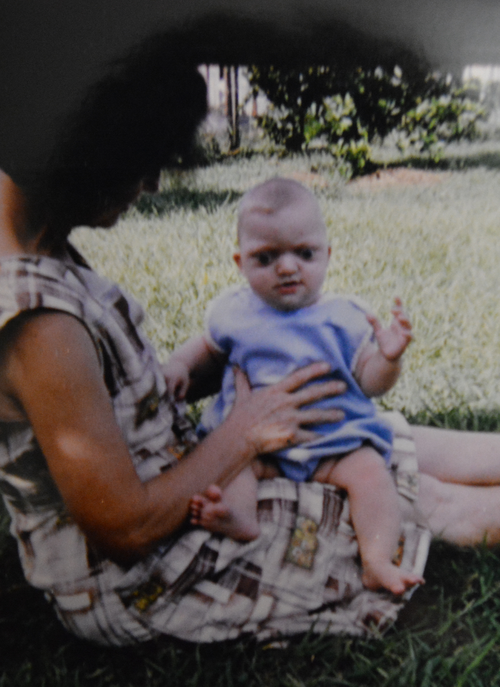 Ms Woolsey as a baby, showing her skull was not fully fused.