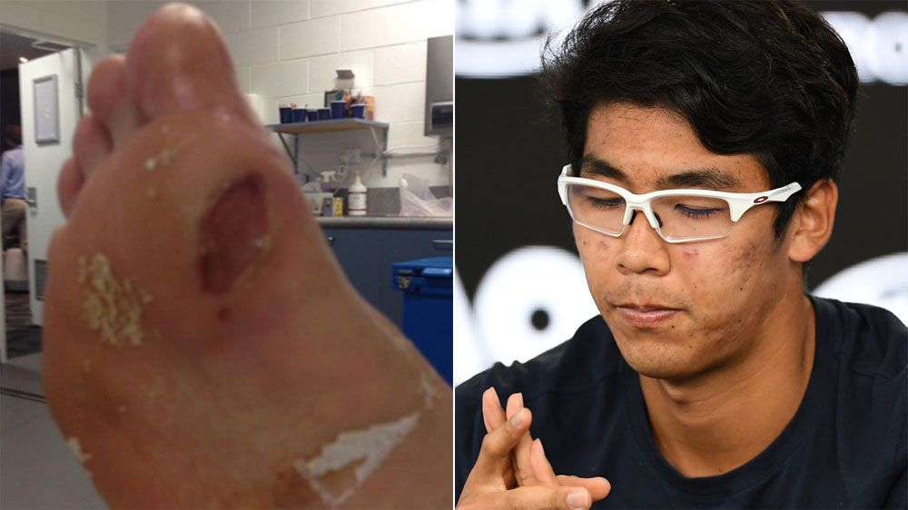 Hyeon Chung reveals state of blister after retiring from Australian Open semi-final against Roger Federer