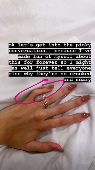 Hailey Baldwin, pinky, health condition, Instagram