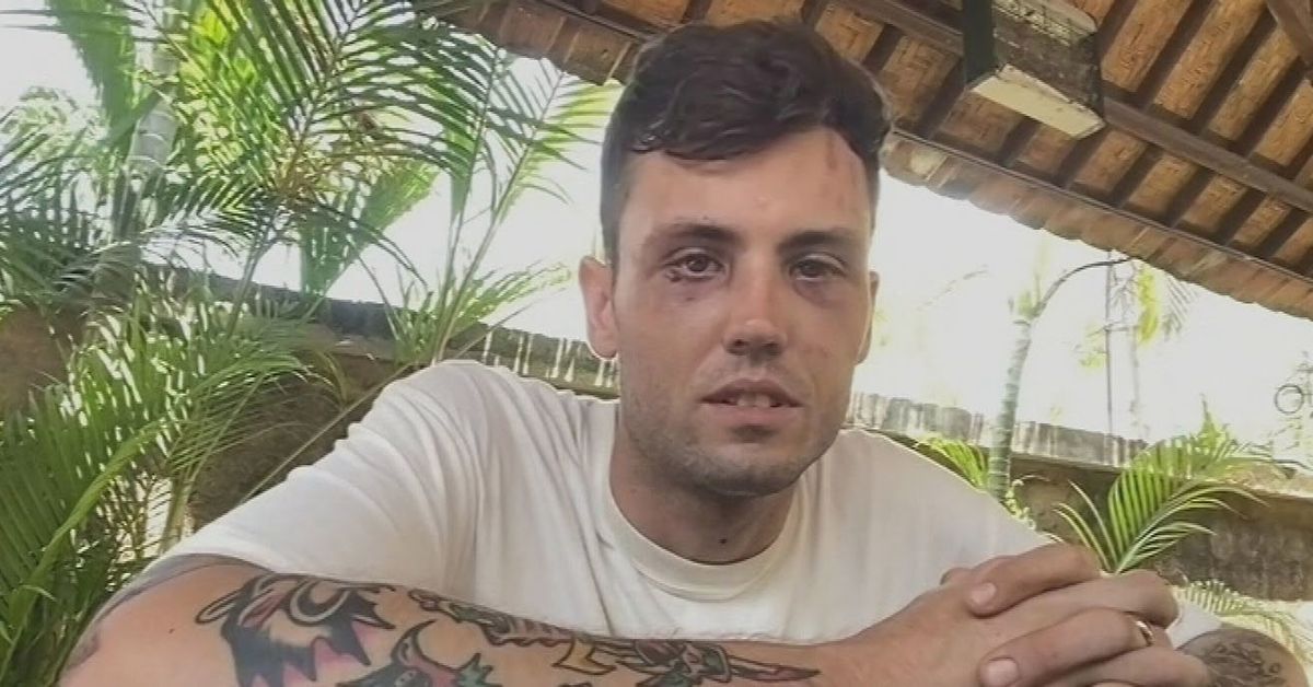 Australian scaffolder needs stitches after 'cowardly' attack in Bali
