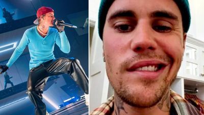 Justin Bieber's face is paralysed after sudden diagnosis 