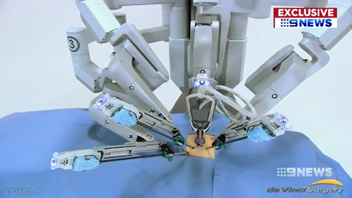 Robotic tentacles are controlled by the surgeon to allow safer and more precise surgery for cancer patients.