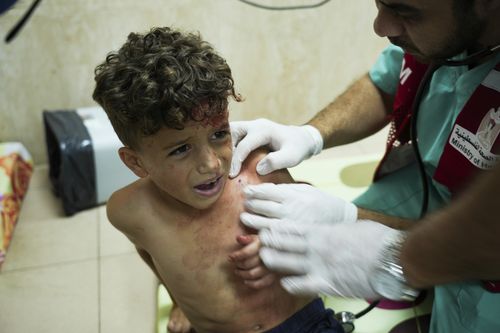 Palestinian child wounded in Israeli bombardment is treated in a hospital in Deir al-Balah, south of the Gaza Strip, Tuesday, Oct. 17, 2023.