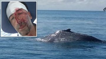 Captain left with gashed face after ‘freak’ encounter with whale