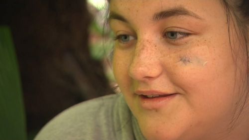 The 15-year-old was left with a screw lodged in her cheek.