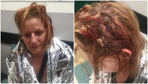 Simone, who is on blood thinners, was left bleeding from the head. (Supplied)