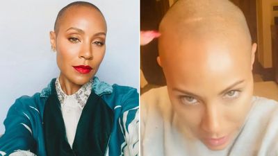Jada Pinkett Smith - Alopecia