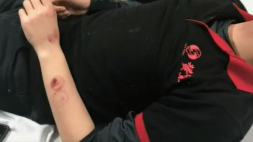 Mr Kong sustained bite marks on his arm during the fight with Quan. (9NEWS)
