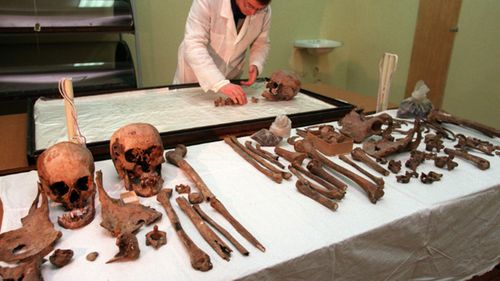Scientist examines exhumed bones of the Romanov family in 1998 (AP Photo/Alexander Zemlianichenko)