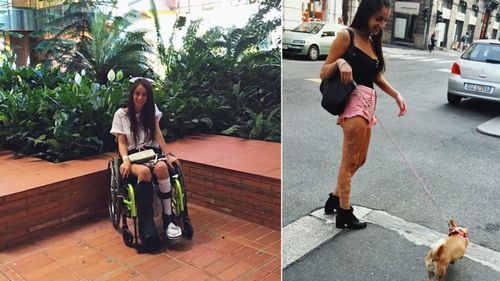 Glenda Merlini pictured before and after her accident. (Photos: Supplied)