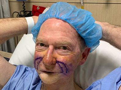 John Blackman, surgery, photo, hospital