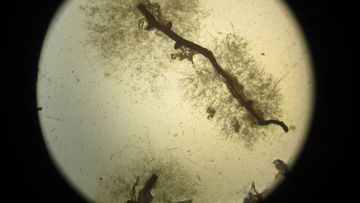  Phytophthora growing out of infected roots on agar