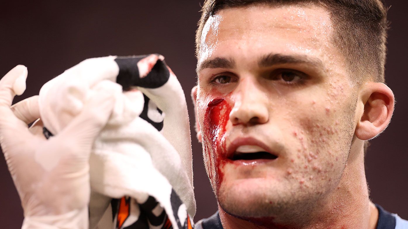 Nathan Cleary of the Blues is attended to by a team trainer after a cut to his face during game one of the 2021 State of Origin series between the New South Wales Blues and the Queensland Maroons at Queensland Country Bank Stadium on June 09, 2021 in Townsville, Australia. (Photo by Mark Kolbe/Getty Images)