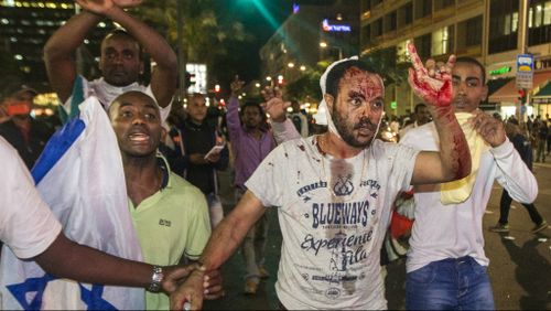 A bloodied protester in the crowd at Tel Aviv. (AFP)