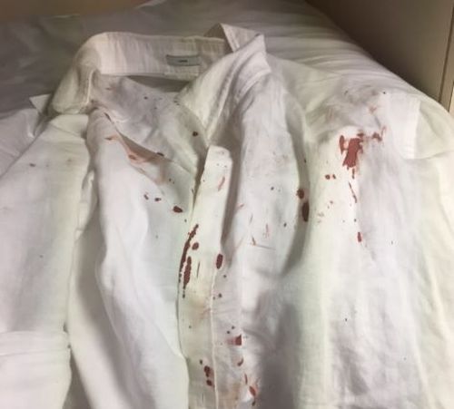Mr Titlow's blood-soaked shirt following the fight. (Supplied)