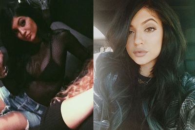 We need to talk about Kylie Jenner's lips, people. They're HUGE.<br/><br/>It's like they've been stung by bees. And she's only just turned 17... what is going on?!