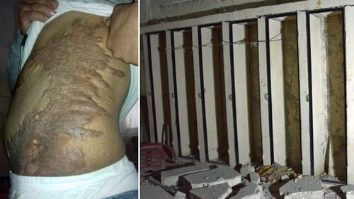 A prisoner shows scars from ISIS torture (left); solitary confinement cells, nicknamed "coffins", where prisoners are confined standing up, in an Islamic State  prison in the Syrian town of al-Bab (right). Source: (International Centre for the Study of Violent Extremism / AFP)